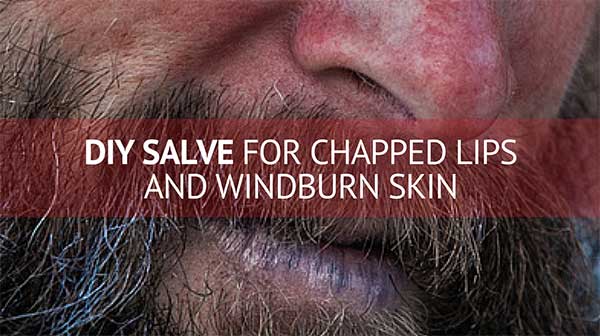 DIY Salve for Chapped Lips and Windburn Skin - Consumer Files