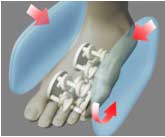 A skeletal image of foot.