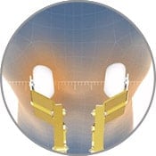 Illustration of Ogawa Smart Sense 3D Spot/Partial