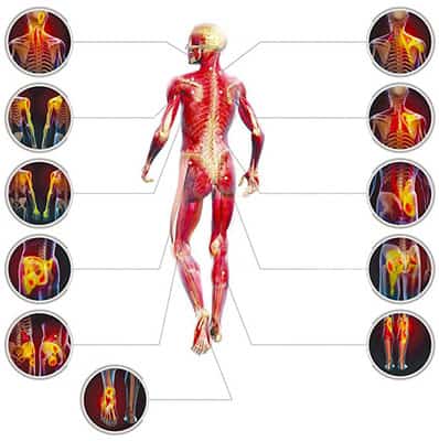 An illustration of the human body and its pressure points